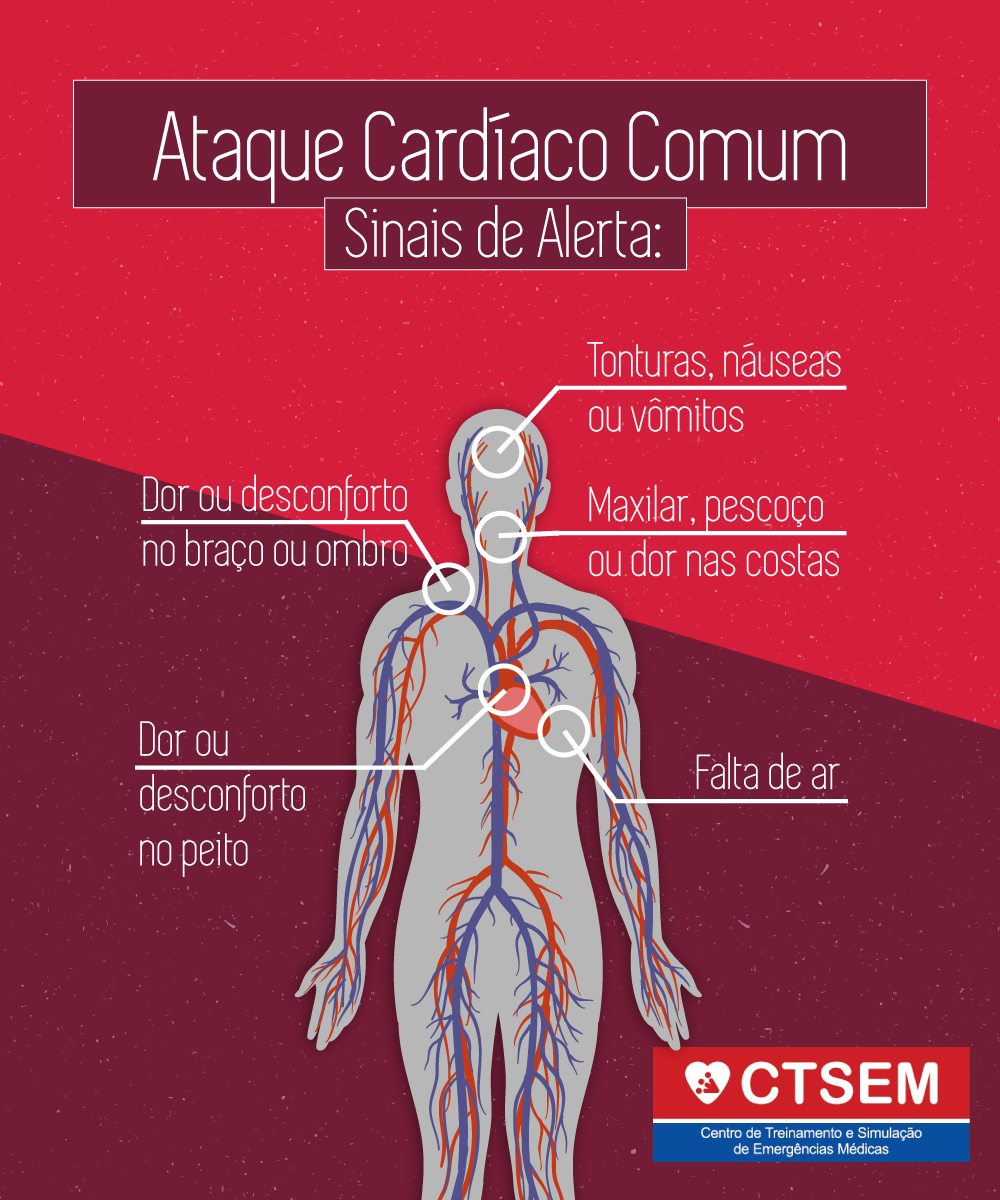 Sinais de infarto: os primeiros sintomas de um ataque cardíaco